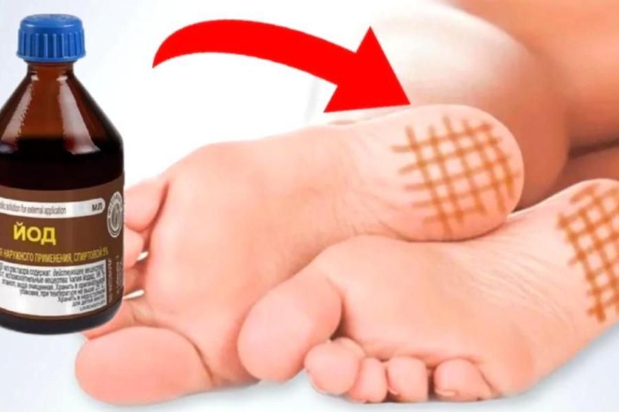 При каких заболеваниях можно применять йодную сетку - мнение врача