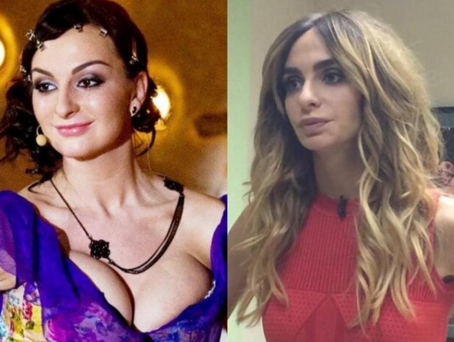 Екатерина Варнава до и после пластики Екатерина Варнава до и после пластики